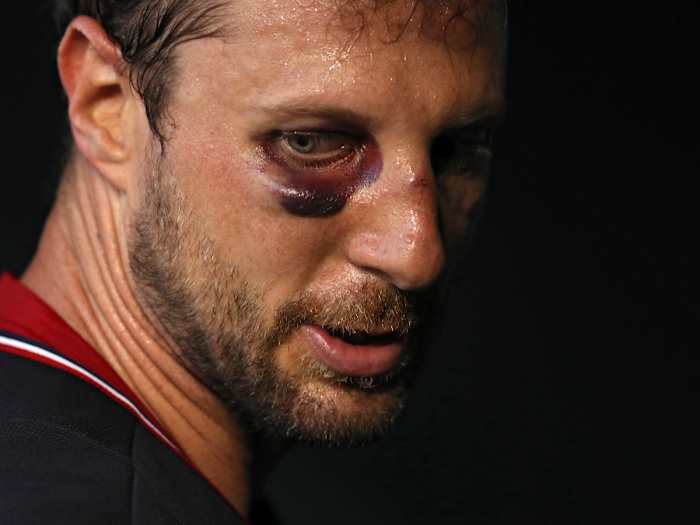 max-scherzer-injury.jpg